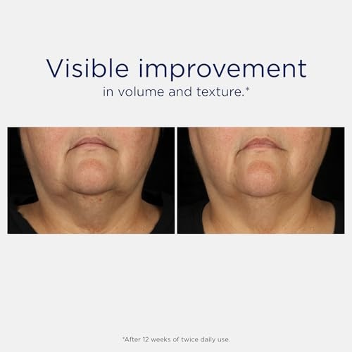 Neostrata Skin Active Tri-Therapy Lifting Serum New and Improved Formula with MicroDiPeptide229 30ml
